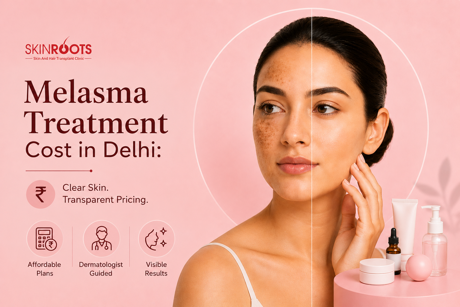 Melasma Treatment Cost in Delhi: What You Should Know Before Starting Treatment
